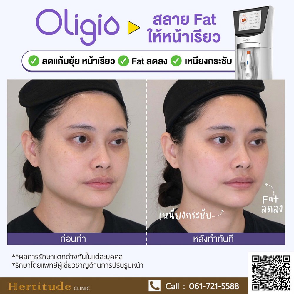 Hertitude CLINIC ขยายสาขาใหม่, ศูนย์การค้าเอ็มสเฟียร์, เฮอร์ทิจูด คลินิก, นวัตกรรมมาตรฐานระดับสากล, นายแพทย์วรพจน์ ศิรามังคลานนท์, นวัตกรรมทางการแพทย์